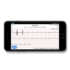 Kép 5/5 - ProMedix PR-650 Android, iOS, EKG, Pulzus és Vérnyomásmérős Vízálló Fekete aktivitásmérő karpánt