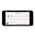 Kép 5/5 - ProMedix PR-650 Android, iOS, EKG, Pulzus és Vérnyomásmérős Vízálló Fekete aktivitásmérő karpánt